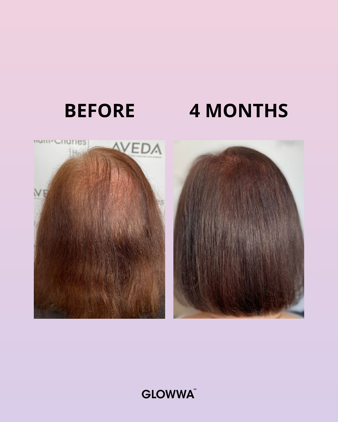 GLOWWA Before & After 3 GLOWWA Before & After 3